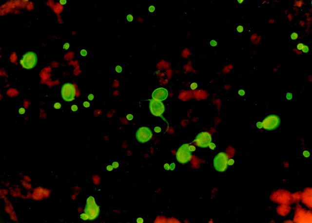 giardia and cryptosporidium